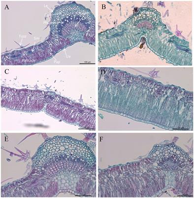 Artificial Regulation Effect of Plant Retardants on Leaf Anatomical Characteristics of Elaeagnus Angustifolia